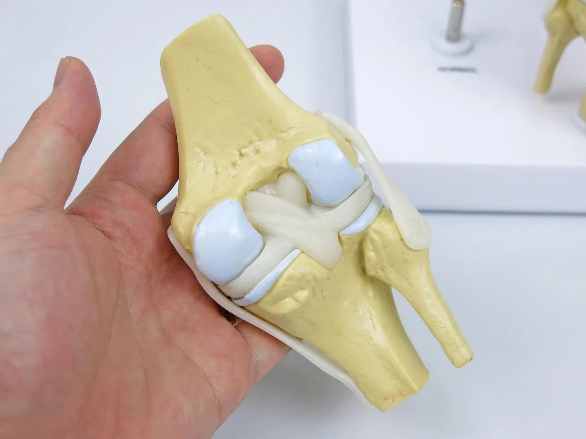 GPI Anatomicals 1100 Osteo-Kniemodellset 4 verschiedener Stadien
